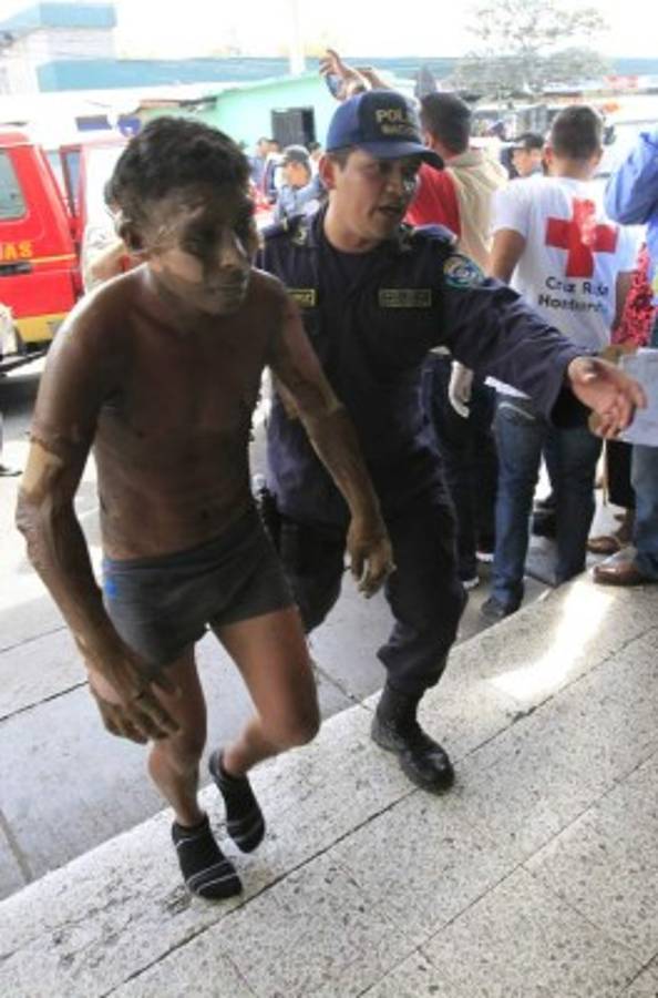 Colapsa sistema sanitario público por incendio