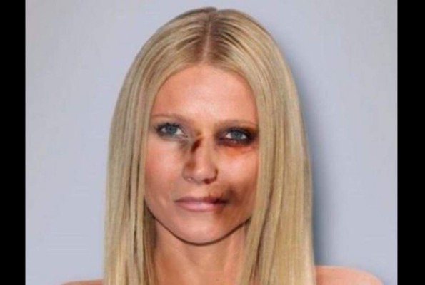 Campaña muestra fotos de celebridades como si fueran víctimas de violencia doméstica