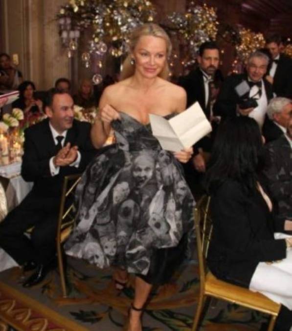 Pamela Anderson pasó por el quirófano y se ve irreconocible