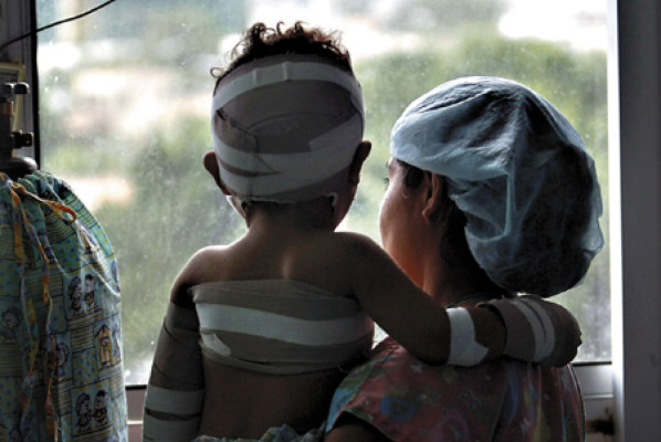 Pólvora hizo estragos en los niños capitalinos