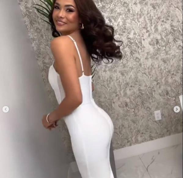 Sirey Morán, presentadora de deportes y su gran cambio tras cirugía estética