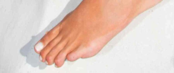 La pequeña imperfección de Miss Universo