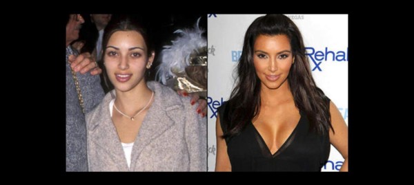 Celebridades antes de la fama: Las fotos que muchos no quieren que veas&nbsp;&nbsp;