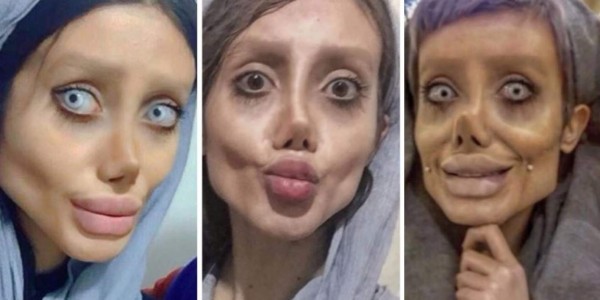 Joven de 19 años se somete a 50 cirugías para parecerse a Angelina Jolie