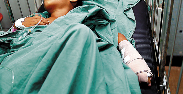 ¿Qué hacer al sufrir una quemadura?