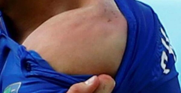 Luis Suárez: el caníbal mundialista de Uruguay