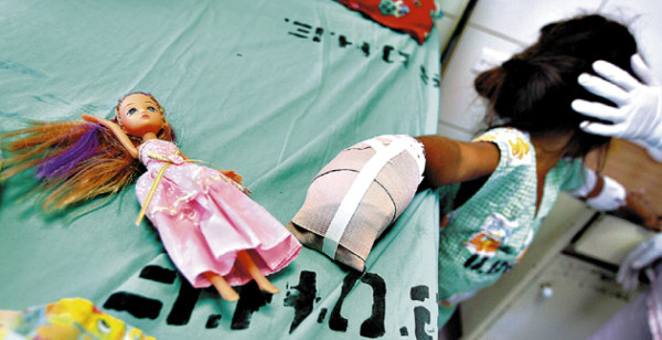 En condición estable niños quemados por pólvora; dos fueron dados de alta