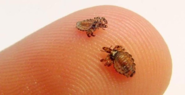 Elimine los piojos con estos remedios caseros