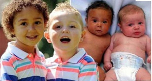 Rarísimo caso de gemelos de padres diferentes en Vietnam&nbsp;&nbsp;