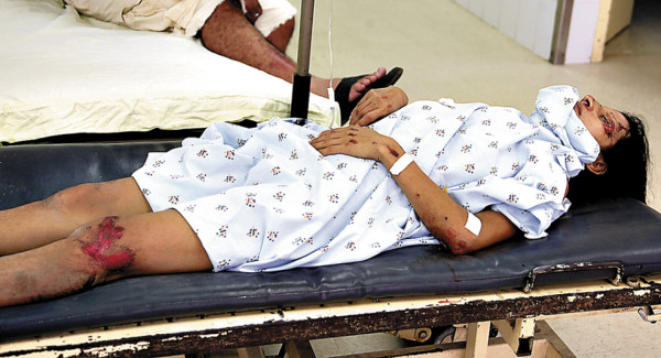 Carro embiste a familia y mata a bebé