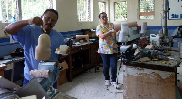 Crece demanda de prótesis por mutilaciones en el Distrito Central
