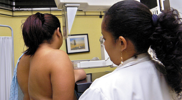 La mastectomía puede salvar su vida