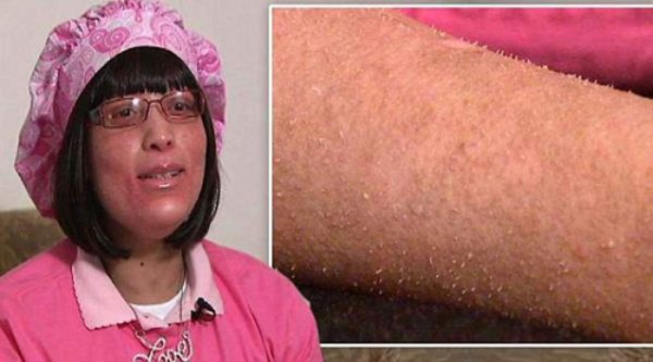 Uñas en vez de pelo