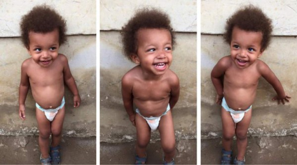 'Hope”, el niño desnutrido que se escapó de las garra de la muerte en África