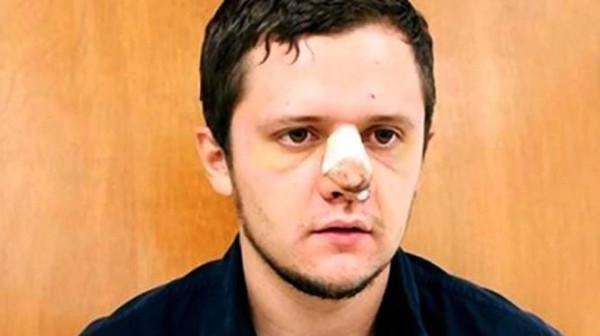 Hondureño entre famosos narcos que se hicieron drásticas cirugías para mantenerse prófugos