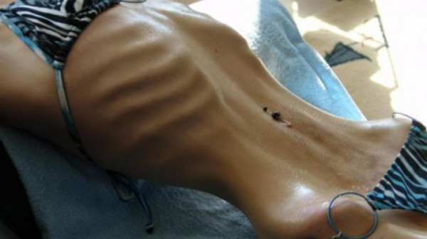 El peor de los casos