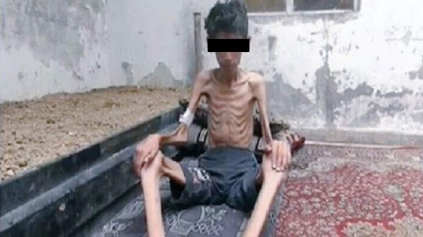 Régimen sirio autoriza el acceso de ayuda humanitaria a ciudad sitiada de Madaya