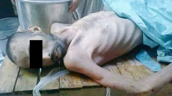 Régimen sirio autoriza el acceso de ayuda humanitaria a ciudad sitiada de Madaya