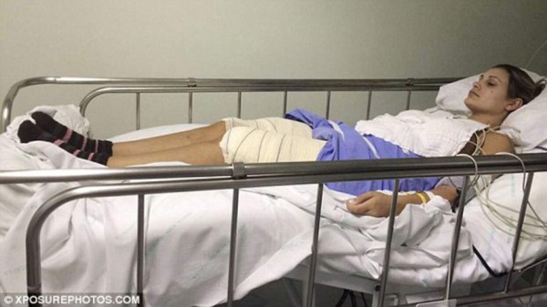 Miss BumBum reveló las horribles secuelas de las cirugías plásticas