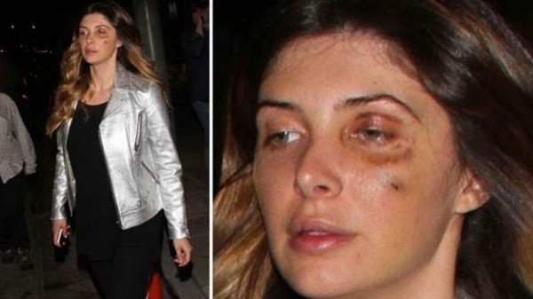 Golpean a sexy exnovia de Luis Miguel