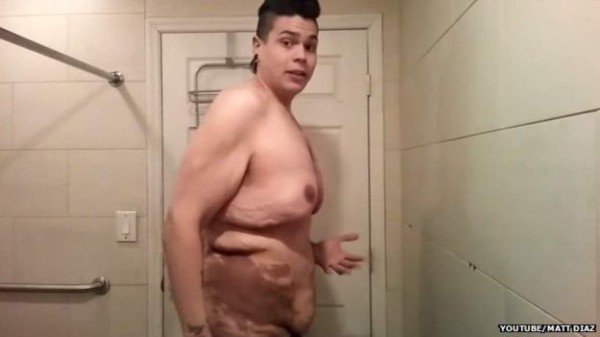 El grito de auxilio de un joven que bajó 120 kilos