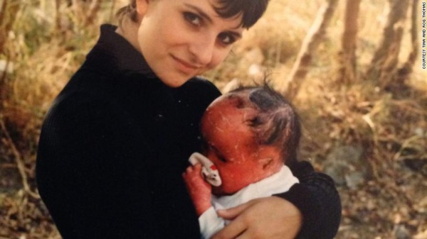 Escondió su rostro por 22 años