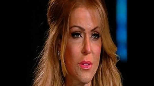Vuelve a 'tener rostro'