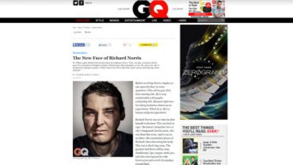 Le trasplantaron la cara y ahora es tapa de una revista de moda