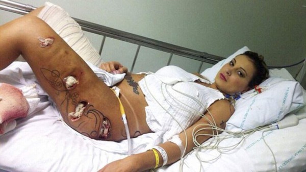 Miss BumBum reveló las horribles secuelas de las cirugías plásticas