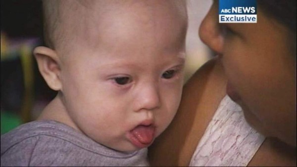 Pareja abandona a bebé con Síndrome de Down de madre de alquiler