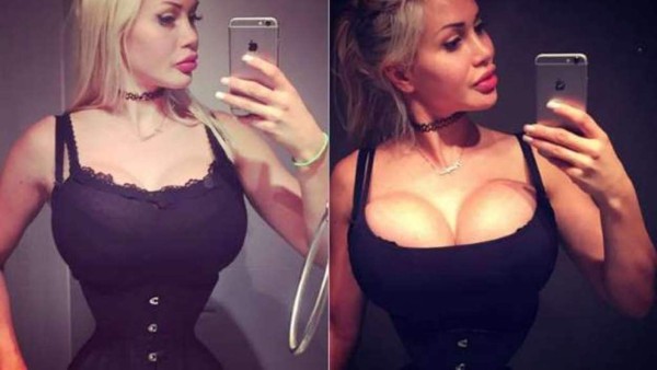 Ella se quitó seis costillas para parecer una caricatura