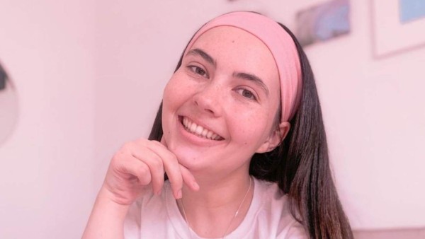 Tessa Hansen-Smith, la mujer alérgica al agua, a sus lágrimas y su sudor