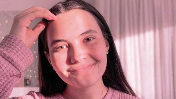 Tessa Hansen-Smith, la mujer alérgica al agua, a sus lágrimas y su sudor