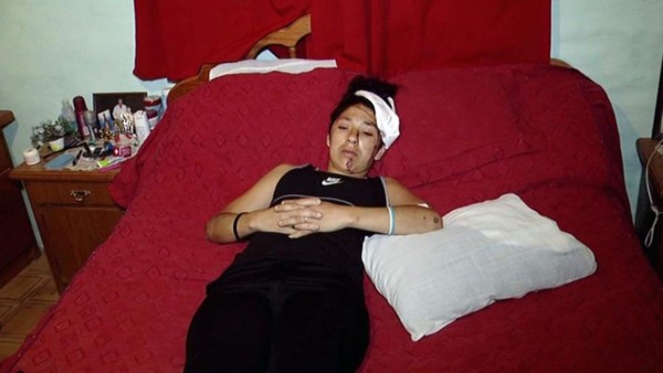 Mujer y su bebé de 7 meses vuelan por el aire tras ser atropellados por ladrones &nbsp;&nbsp;