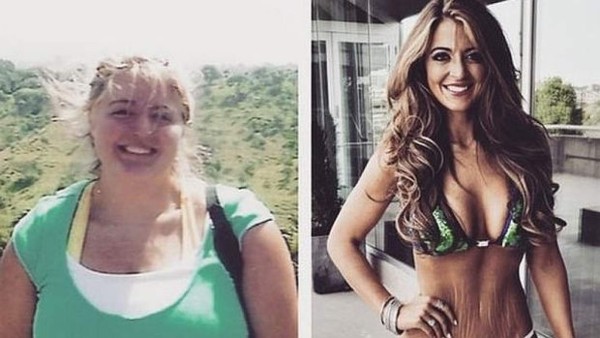 Modelo que luce con orgullo sus estrías se vuelve famosa en EEUU&nbsp;&nbsp;