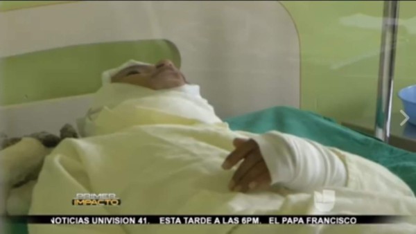 Joven prende en llamas a un menor en La Lima, Perú