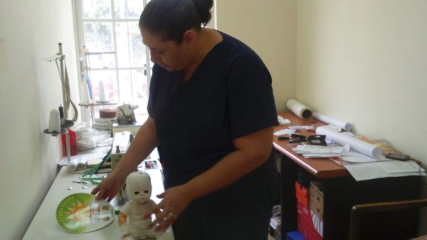 Rehabilitaran a adultos con lesiones de quemaduras en la capital