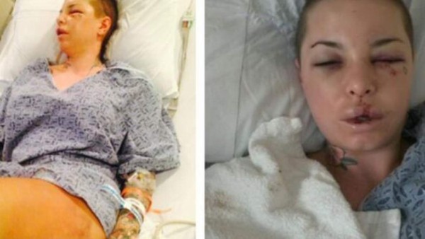 Reconocido peleador propina golpiza a su novia