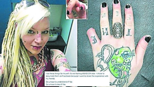 Las insólitas amputaciones que se hizo una mujer británica por estética