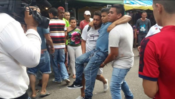 Tirotean a guardia de seguridad y vendedor en barrio El Centro de San Pedro Sula