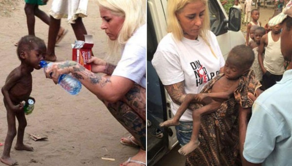 'Hope”, el niño desnutrido que se escapó de las garra de la muerte en África