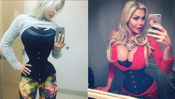 Ella se quitó seis costillas para parecer una caricatura