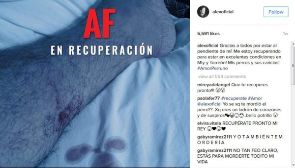 Operan por gangrena a cantante Alejandro Fernández