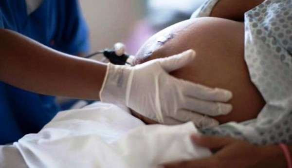 Honduras: Hongo tóxico mata a madre e hija