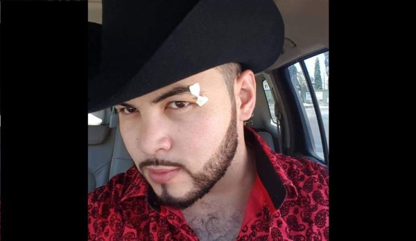 Lo balacean tras salir de uno de sus conciertos y herido transmite un video