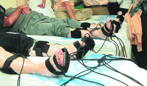 A diario dos personas sufren una amputación en el Hospital Escuela