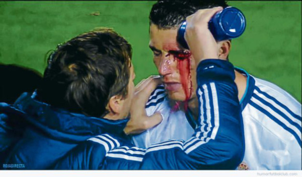 Portugal descarta a Cristiano Ronaldo