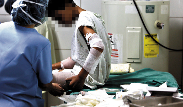 Ingresa tercer niño quemado por pólvora