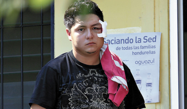 Carro embiste a familia y mata a bebé