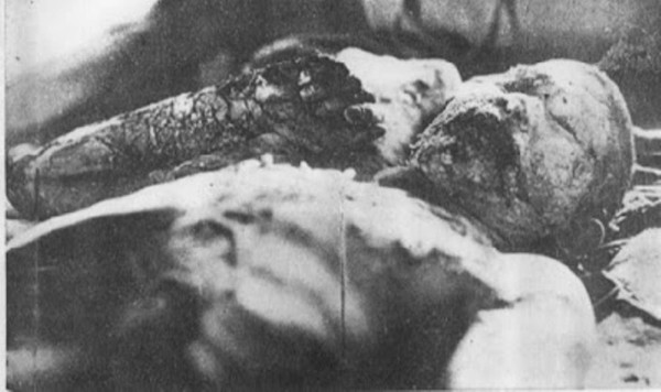 Imágenes de la tragedia en Hiroshima